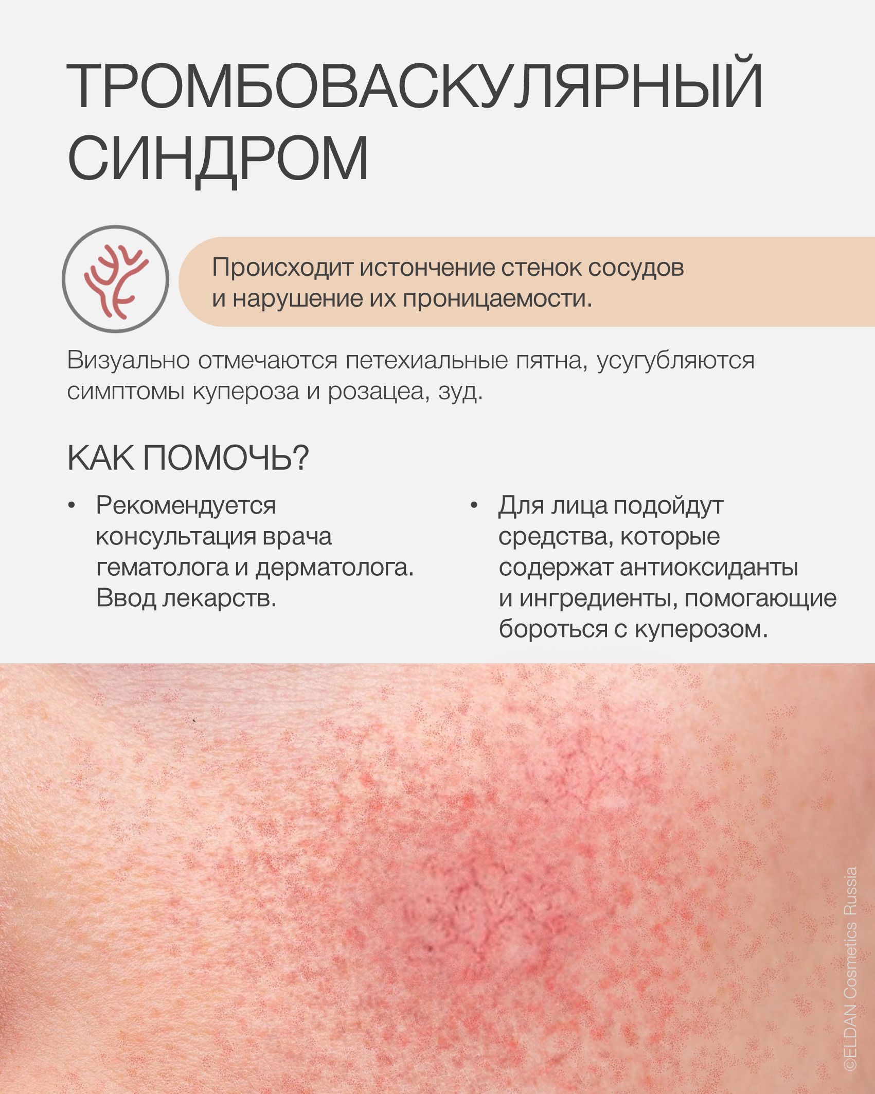 Пост ковид и кожа5.jpg Пост ковид и кожа5.jpg